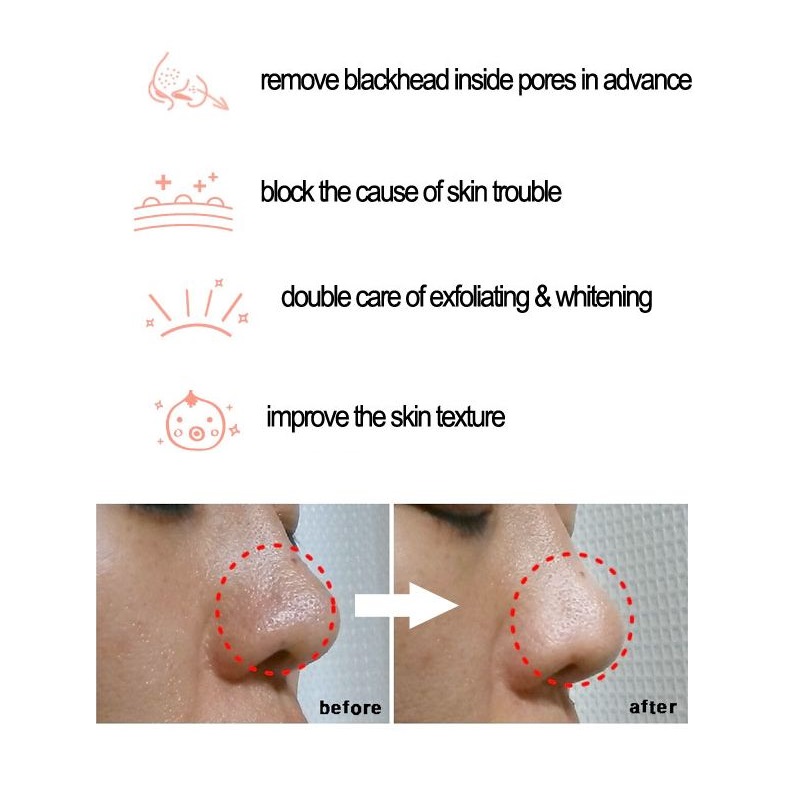 Cosrx BHA 블랙헤드 파워 리퀴드 오일 컨트롤 진 - Skincare Cosrx 리뷰 및 가격