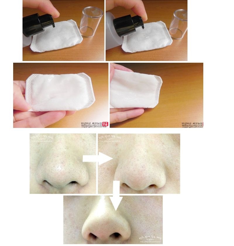 Cosrx BHA 블랙헤드 파워 리퀴드 오일 컨트롤 진 - Skincare Cosrx 리뷰 및 가격
